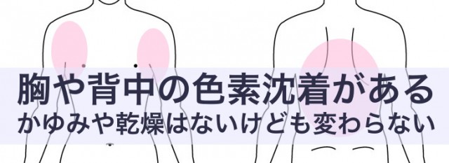 体の色素沈着 症例１ 川崎市多摩区のアトピー専門整体 英気治療院