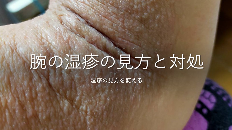 腕に出るアトピーの湿疹の見方と対処 川崎市多摩区のアトピー専門整体 英気治療院
