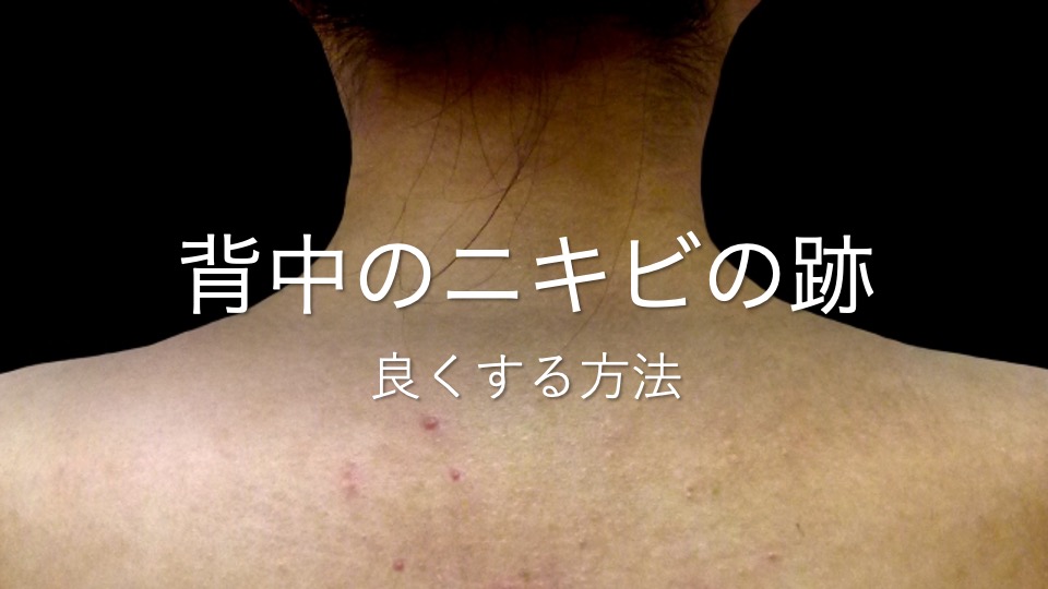 背中のできものの跡が治る方法はありますか？ | 川崎市多摩区のアトピー専門整体「英気治療院」