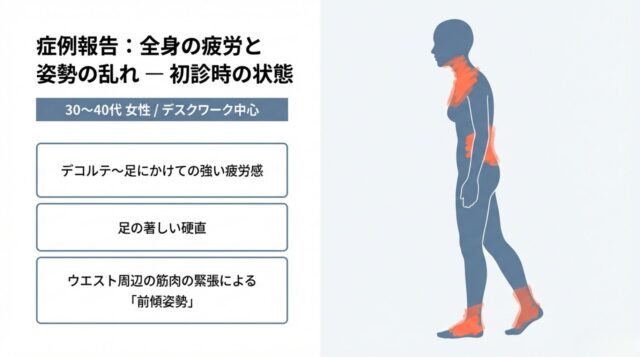 デスクワーク中心の生活により、デコルテから足元まで強い疲労感を感じていた事例です。特に足の硬直と、ウエスト周りの緊張からくる「前傾姿勢」が目立っていました。ご自身の姿勢が、知らず知らずのうちに疲れを溜め込んでいる原因かもしれません。