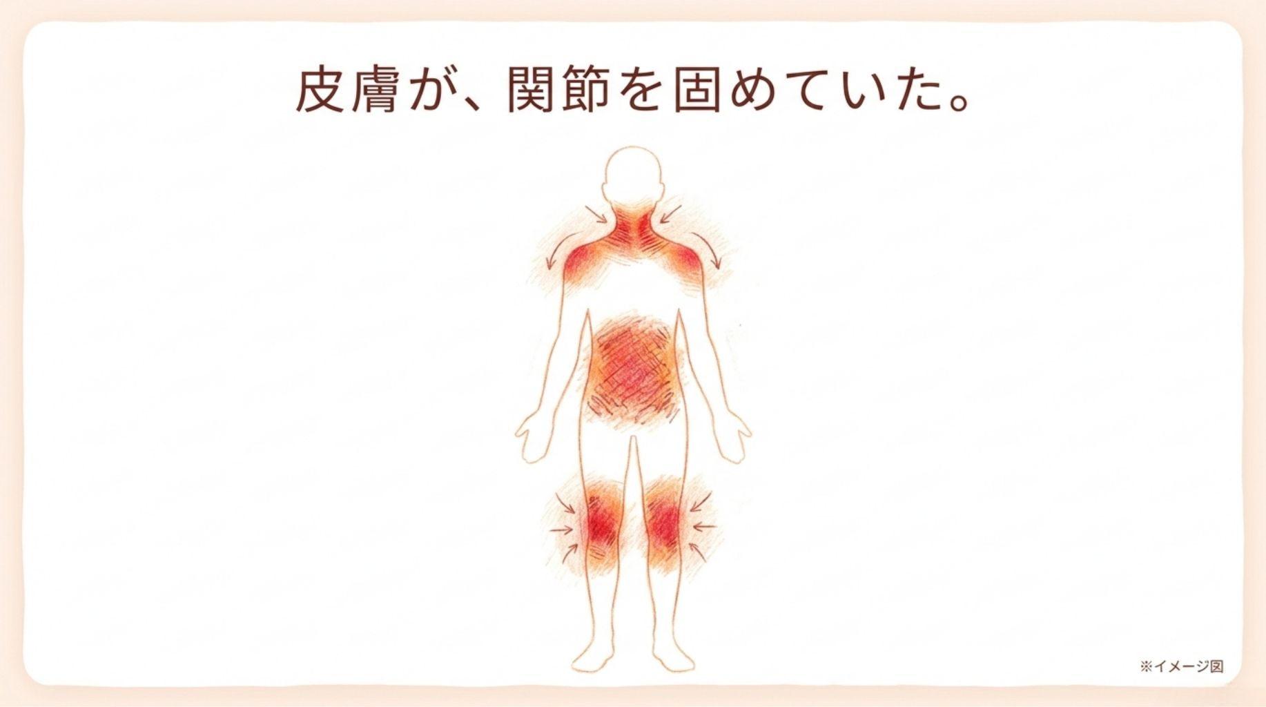 皮膚の柔軟性と関節可動域の真実：慢性皮膚炎における「組織の硬化」を