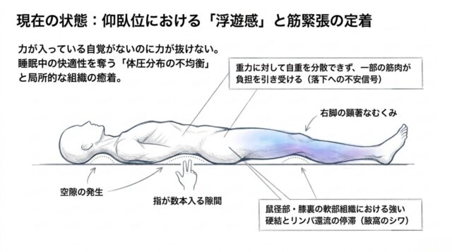 仰向けの人体図。腰の下に指を差し入れるイラストと、脚のむくみや組織の硬結を説明する引き出し線付きのテキスト。