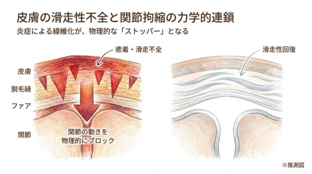 皮膚・ファシア・関節の層構造の模式図。左側は癒着して「関節の動きを物理的にブロック」している様子、右側は滑走性が改善された様子。