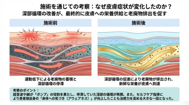 施術前後の断面図を比較し、血流促進によって老廃物が排出され栄養が行き渡る仕組みを示した図