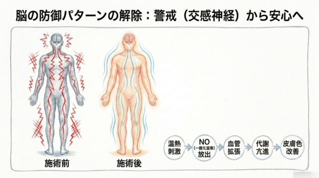 温熱と刺激から一酸化窒素放出、血管拡張、代謝亢進へと続くフローチャート。