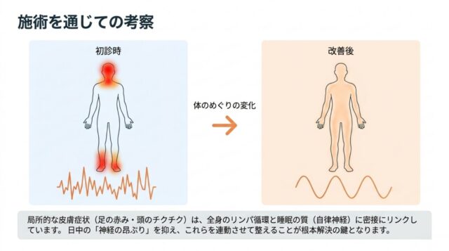 「初診時」から「改善後」への変化を矢印で示し、下部に「局所的な皮膚症状は全身のリンパ循環と睡眠の質にリンクしている」というまとめの文章が記載されたスライド。