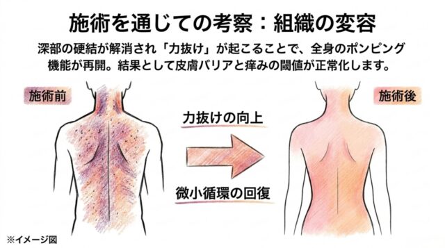施術前後の変化を示す2つの人影。左側は強張った様子、右側は周囲に明るいオーラのような光を纏い、組織が活性化して循環が良くなった様子を視覚化したイメージ図。