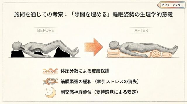 仰向けに寝た人物の図。首、腰、膝の下にサポートが置かれ、脊椎が安定している状態。
