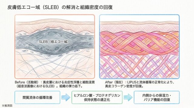 皮膚の炎症による空隙（SLEB）が解消され密度が高まった組織断面図の比較と、今後の管理方針として「体のめぐり」「薬の活用」「セルフケア」を説明する3つのテキストボックス。