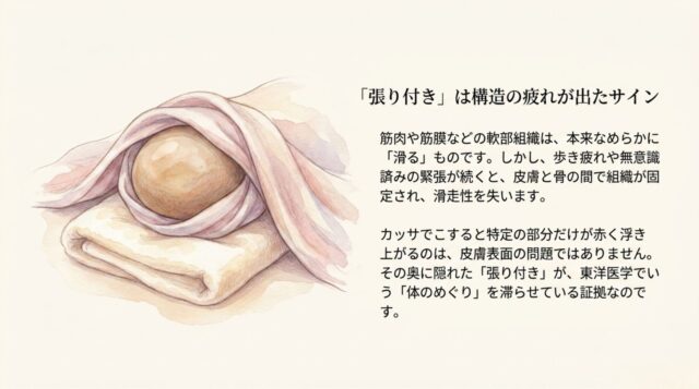 「『張り付き』は構造の疲れが出たサイン」の見出し。軟部組織の滑走性の喪失と、カッサによる反応のメカニズムを説明するテキスト。