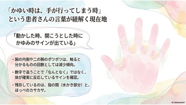 淡いパステル調の背景。右側に淡いピンク色の手のひらのイラストがあり、指の間の水かき部分4箇所に黄色いドットが密集して描かれ、手の輪郭を囲むようにカラフルな波線が描かれている。左側には「動かした時、開こうとした時にかゆみのサインが出ている」という吹き出しと、残存する症状（指の間、ほっぺのカサカサ）などを整理したテキストボックスがある。