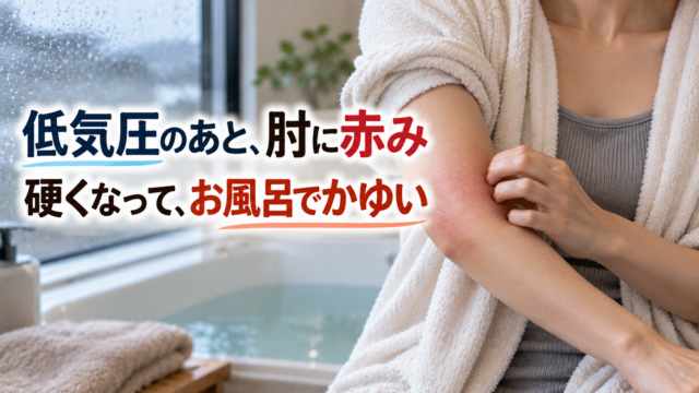 低気圧が続いたあとに肘の赤みと硬さが現れ、お風呂でかゆみを感じる女性