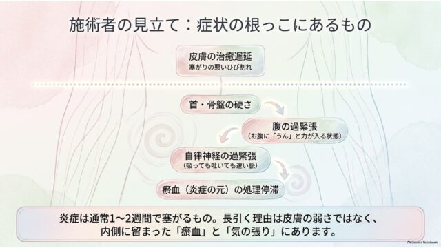 表面的な皮膚の治癒遅延の下に、首・骨盤の硬さや腹・自律神経の過緊張、瘀血の停滞が連鎖している深層構造を示したステップ図。