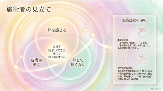 : 3つの指標の重なり合うベン図と、手のイラストを用いて温度感覚の逆転現象を解説している施術の見立てに関するスライド。